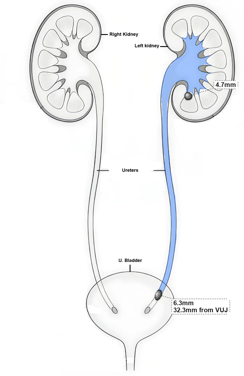 Complex KUB Reporting Diagram